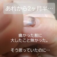 画像1609